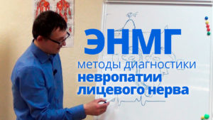 Невропатия лицевого нерва. ЭНМГ диагностика